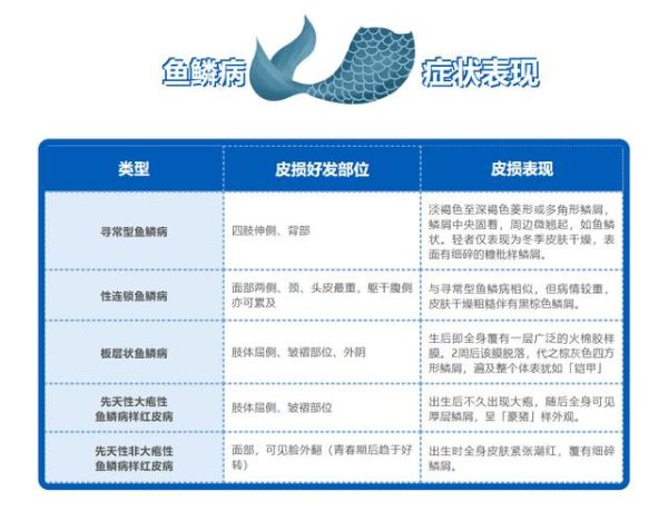 双鱼癫是什么病_双鱼癫早期症状有哪些
