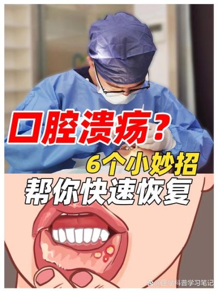 魔羯长溃疡怎么办_魔羯座口腔溃疡原因